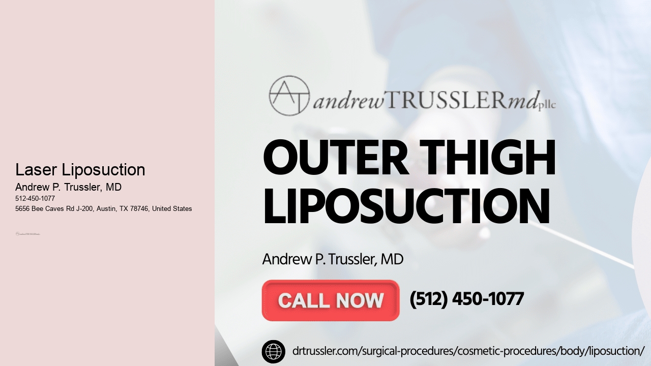 Laser Liposuction